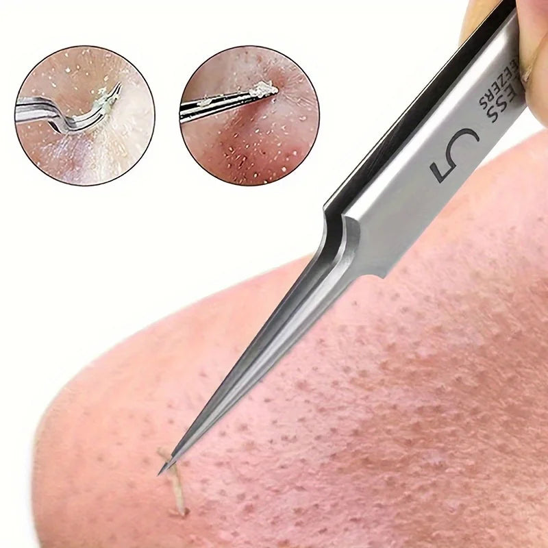 precisionpoint blackhead tweezers